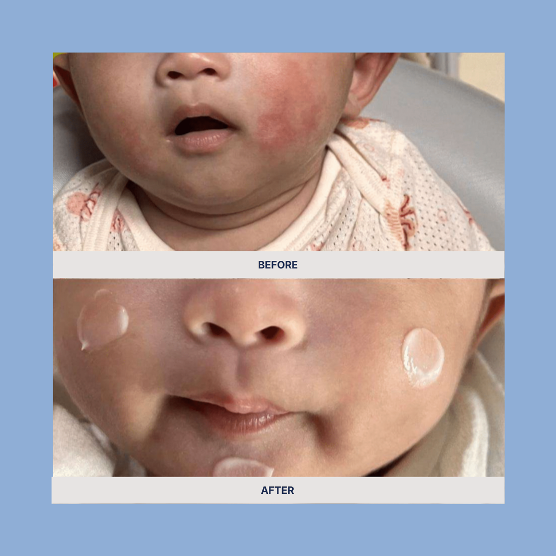 Mongdies Ato Balm 30g - official product detail 5
