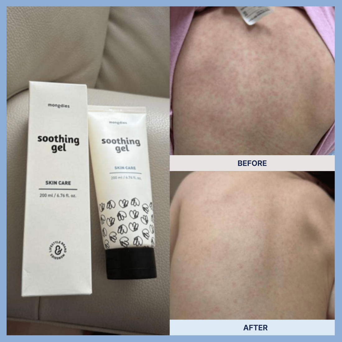 Mongdies Soothing Gel 200ml - official product detail 8