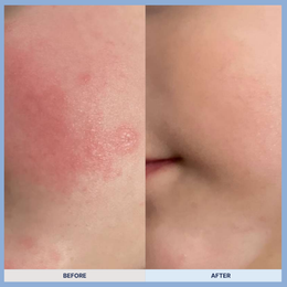 Mongdies Cica Repair Cream
